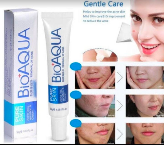 Bioaqua Acne Cream