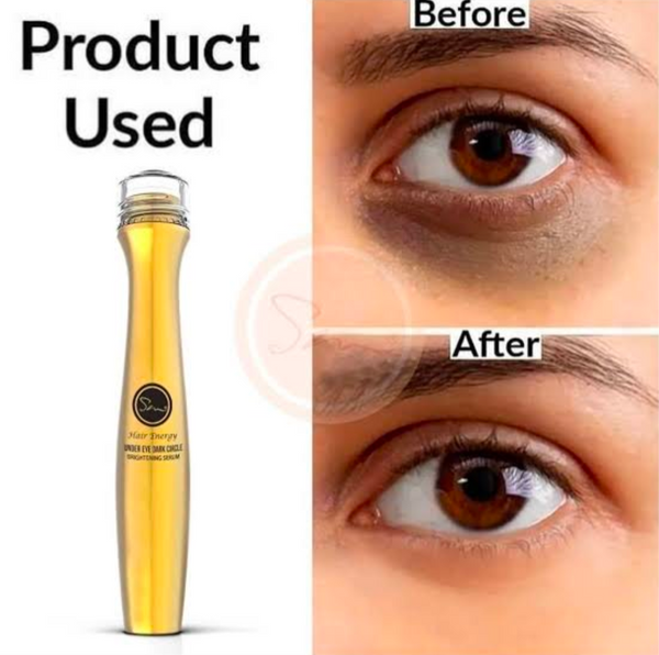 Dar Circles Remover Roller